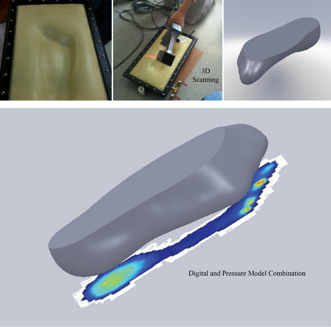 Pressure Reducing Orthotic Kathleen O'Donnell Design